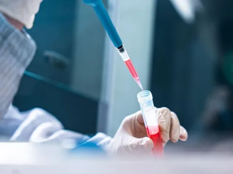 SIAM Thailand chính thức bước vào lĩnh vực y học tái tạo với Ngân hàng mô Vicells