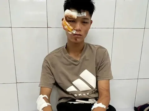 "Quái xế" khóc và khai về việc đi vào đường cấm, tông chiến sĩ cảnh sát cơ động