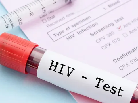 1 thành phố ghi nhận hơn 3.000 ca nhiễm HIV mới trong 9 tháng đầu năm 2025: 81% lây qua con đường này