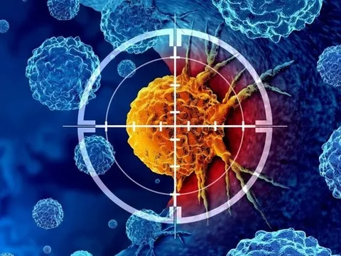 Bệnh nhân ung thư được phát hiện sớm nhờ thiết bị này