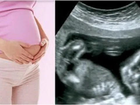 Từ ngày 15.5, hành vi bói toán để xác định giới tính thai nhi sẽ bị xử phạt