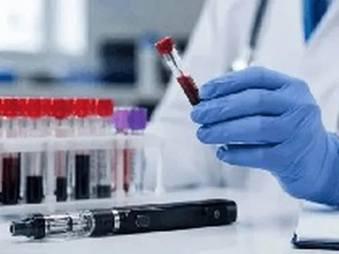 Chưa dừng ở bán thuốc và tiêm chủng, Long Châu tiến sang mảng xét nghiệm, miễn phí lấy mẫu tận nhà